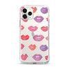 Phone Case, Lots of Kisses