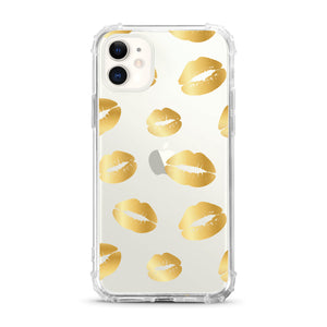 Lips iPhone Case | OTM Essentials