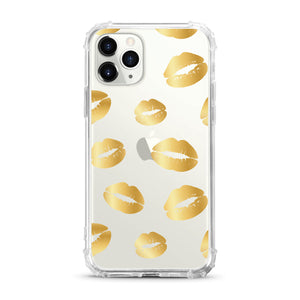 Lips iPhone Case | OTM Essentials